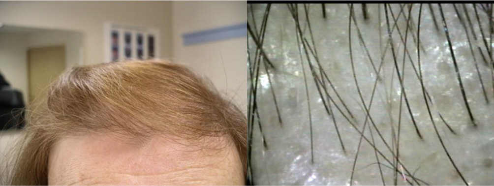 Client 5 After 4 Months