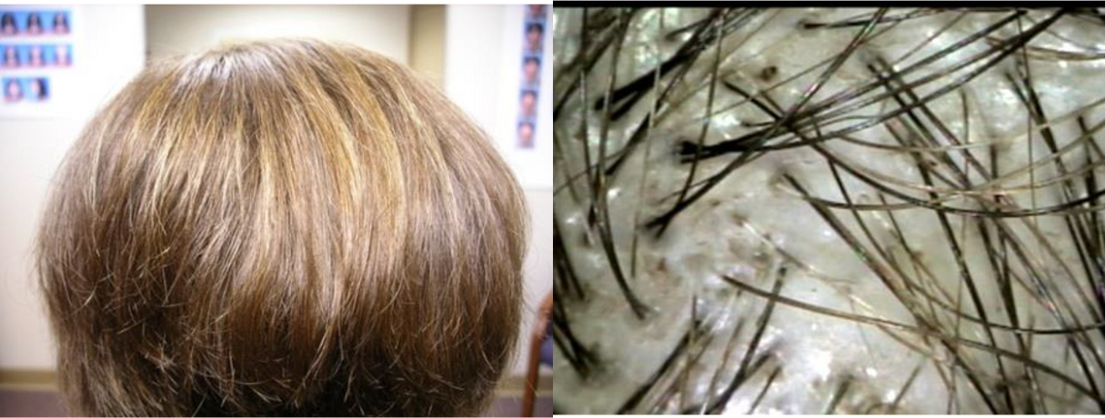 Client 5 After 8 Months Rear