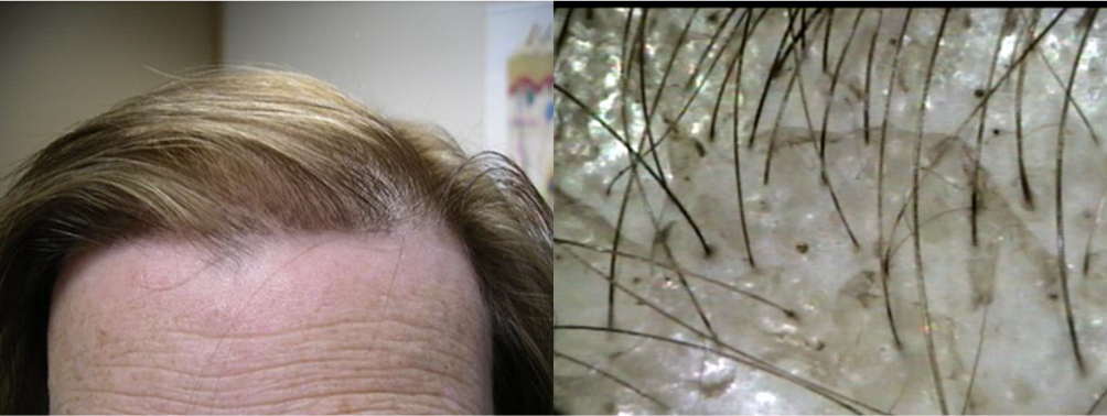 Client 5 After 8 Months Front